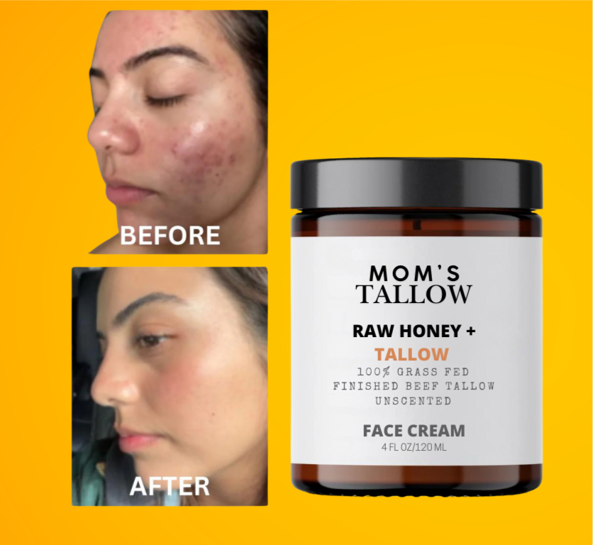 Skin Serenity Face Cream – Nourishing Balm for Sensitive & Flaky Skin