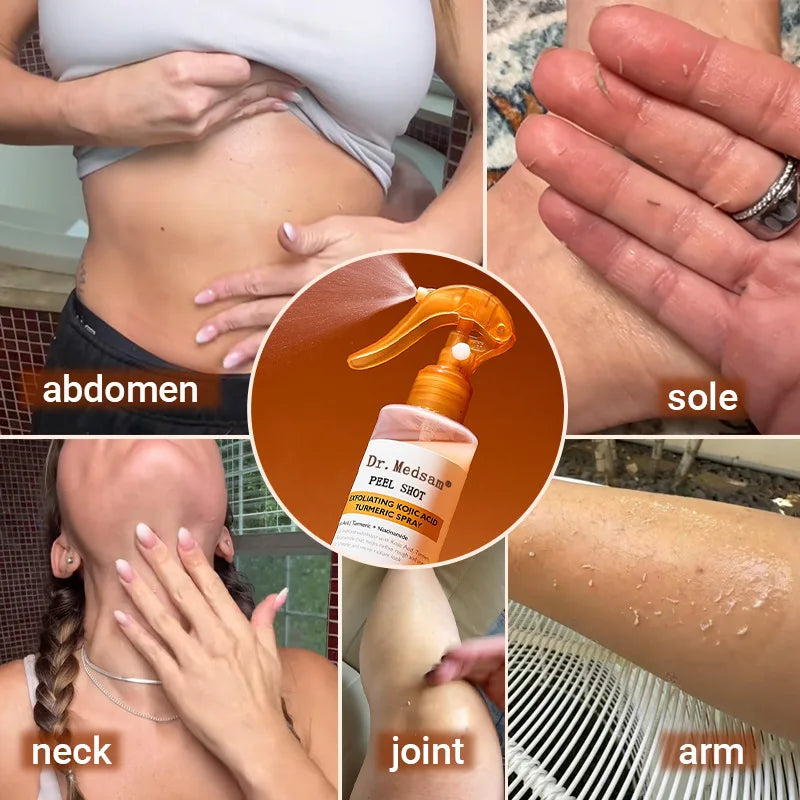Exfoliating Turmeric Spray Body and Face Peel Spray Soothing Moisturizing Skin 200ml Exfoliating Kojic Acid Turmeric Spray