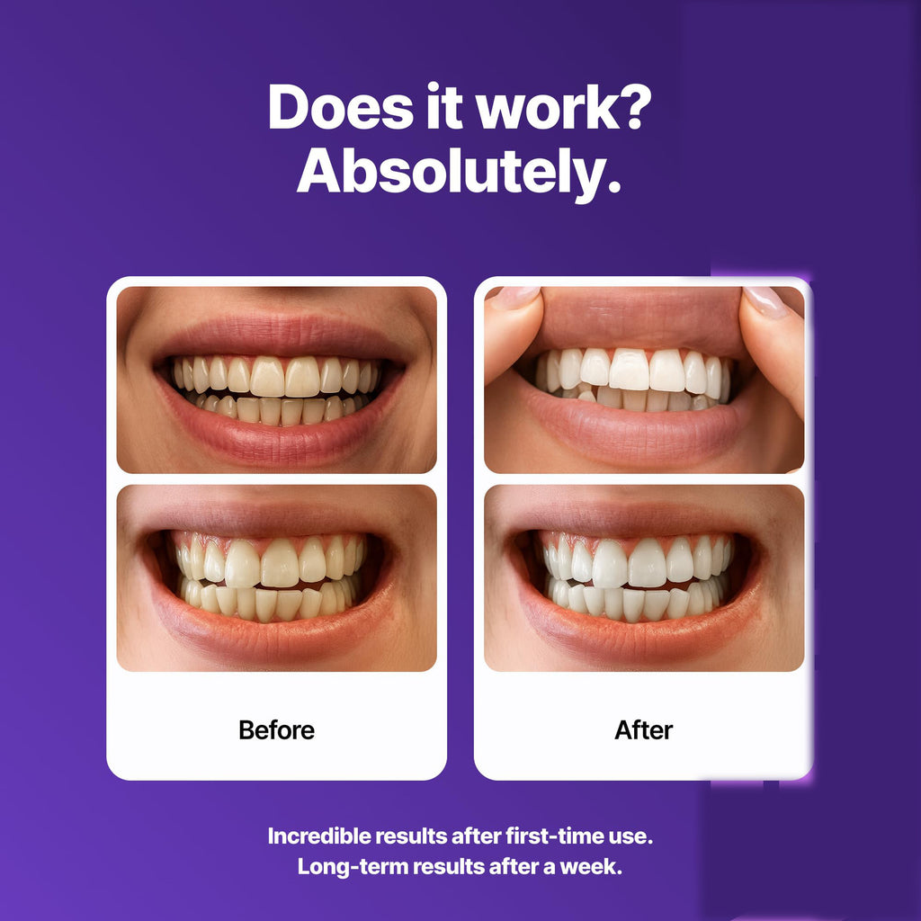 DRDENT Purple Teeth Whitening Strips - 7/21 Whitening Sessions - Safe for Enamel - Non Sensitive Teeth Whitening - Peroxide-Free